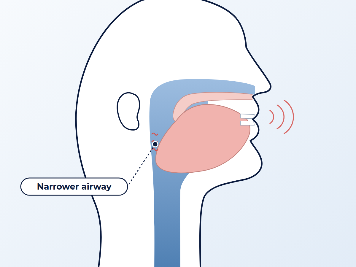 Jaw relaxed